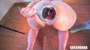 Argendana & Analmaster in EXTREME ANAL TUNNEL EXPERIMENT FOR MY POOR ASS video from ANALVIDS