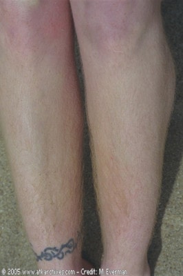 Violet  from ATKARCHIVES