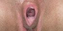 MARLEM