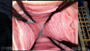 Endoscope Slave Pussy Inspection gallery from SENSUALPAIN - #11