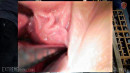 Endoscope Slave Pussy Inspection gallery from SENSUALPAIN - #3