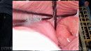 Endoscope Slave Pussy Inspection gallery from SENSUALPAIN - #8
